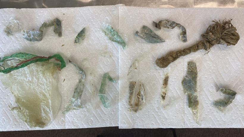 Garbage found in deer 1